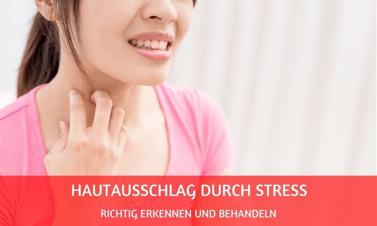 Hautausschlag durch Stress: So kannst Du ihn erkennen und behandeln